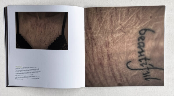 BORDERLINE – Bild 5