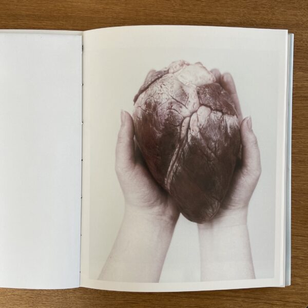 ANGST Collector's Edition – Bild 6